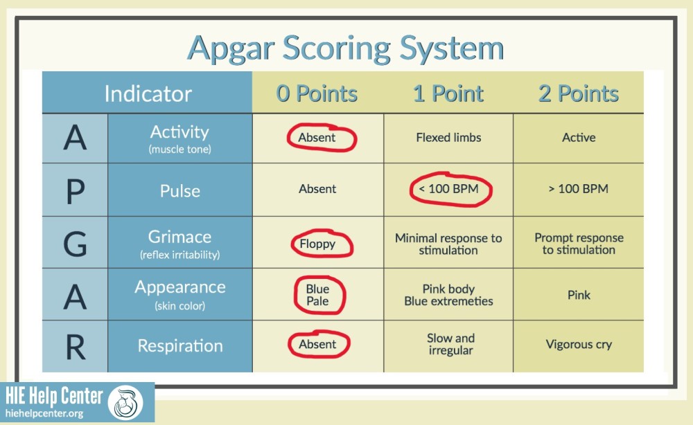An APGAR score chart