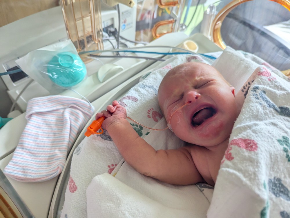 a baby Vienna Reichart pulling out her nasal feeding tube